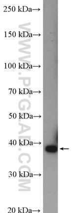 CTGF Antibody in Western Blot (WB)