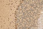 ACIN1 Antibody in Immunohistochemistry (Paraffin) (IHC (P))