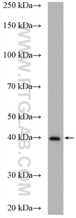 SOX12 Antibody in Western Blot (WB)