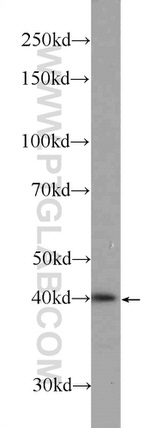 SOX12 Antibody in Western Blot (WB)