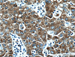 MTTP/MTP Antibody in Immunohistochemistry (Paraffin) (IHC (P))