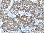 MTTP/MTP Antibody in Immunohistochemistry (Paraffin) (IHC (P))