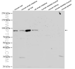 MTTP/MTP Antibody in Western Blot (WB)