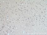 FRMPD4 Antibody in Immunohistochemistry (Paraffin) (IHC (P))