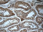 HEATR4 Antibody in Immunohistochemistry (Paraffin) (IHC (P))