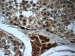 HEATR4 Antibody in Immunohistochemistry (Paraffin) (IHC (P))