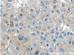 IGHMBP2 Antibody in Immunohistochemistry (Paraffin) (IHC (P))