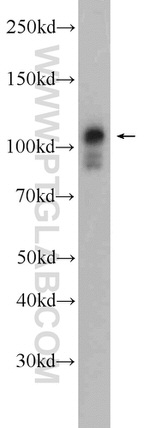 IGHMBP2 Antibody in Western Blot (WB)