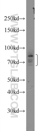 CHPF N-terminal Antibody in Western Blot (WB)