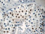 NSBP1 Antibody in Immunohistochemistry (Paraffin) (IHC (P))