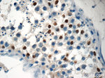 NSBP1 Antibody in Immunohistochemistry (Paraffin) (IHC (P))