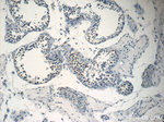 NSBP1 Antibody in Immunohistochemistry (Paraffin) (IHC (P))
