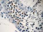 NSBP1 Antibody in Immunohistochemistry (Paraffin) (IHC (P))