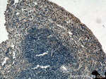BCL3 Antibody in Immunohistochemistry (Paraffin) (IHC (P))