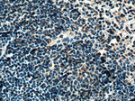 BCL3 Antibody in Immunohistochemistry (Paraffin) (IHC (P))