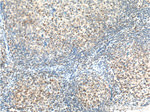 BCL3 Antibody in Immunohistochemistry (Paraffin) (IHC (P))