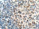 BCL3 Antibody in Immunohistochemistry (Paraffin) (IHC (P))