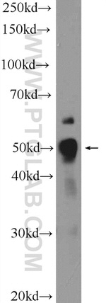 BCL3 Antibody in Western Blot (WB)