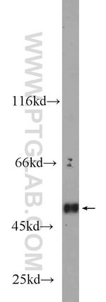 CLEC14A Antibody in Western Blot (WB)