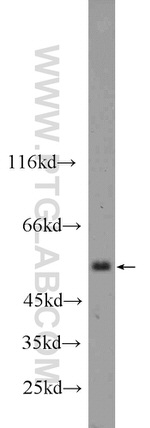 CLEC14A Antibody in Western Blot (WB)