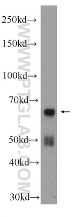 HOMEZ Antibody in Western Blot (WB)
