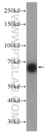 HOMEZ Antibody in Western Blot (WB)