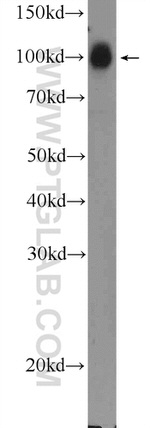STRN3 Antibody in Western Blot (WB)