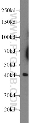 XKR6 Antibody in Western Blot (WB)