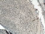RCOR2 Antibody in Immunohistochemistry (Paraffin) (IHC (P))