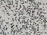 RCOR2 Antibody in Immunohistochemistry (Paraffin) (IHC (P))
