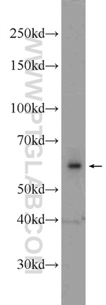 RCOR2 Antibody in Western Blot (WB)