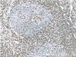 CD2 Antibody in Immunohistochemistry (Paraffin) (IHC (P))