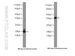 GR repeat Antibody in Western Blot (WB)