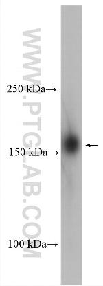 UTX Antibody in Western Blot (WB)