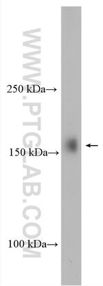 UTX Antibody in Western Blot (WB)