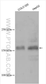 UTX Antibody in Western Blot (WB)