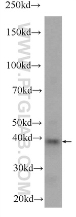 BRMS1L Antibody in Western Blot (WB)