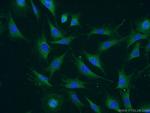 ATPBD4 Antibody in Immunocytochemistry (ICC/IF)