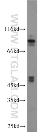 ATPBD4 Antibody in Western Blot (WB)