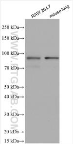AMPD3 Antibody in Western Blot (WB)