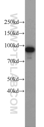 AMPD3 Antibody in Western Blot (WB)