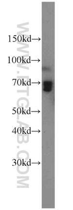 AMPD3 Antibody in Western Blot (WB)