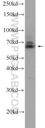 ANKRD13A Antibody in Western Blot (WB)
