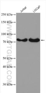ANKRD13A Antibody in Western Blot (WB)