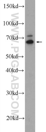 ANKRD13A Antibody in Western Blot (WB)