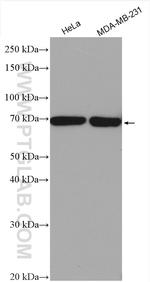 ANKRD13C Antibody in Western Blot (WB)