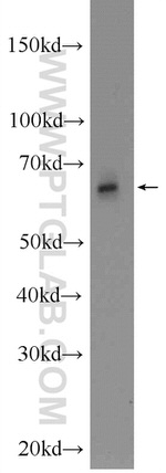 ANKRD13C Antibody in Western Blot (WB)