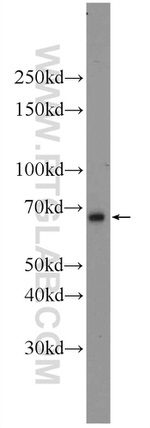 ANKRD13C Antibody in Western Blot (WB)
