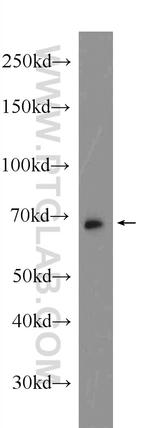 ANKRD13C Antibody in Western Blot (WB)