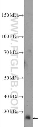 LIN28B Antibody in Western Blot (WB)